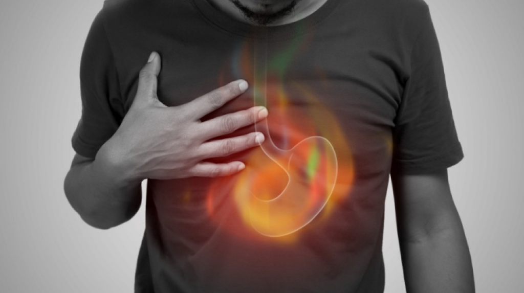 A Holistic Perspective on Chronic Acid Reflux and Inflamed Esophagus